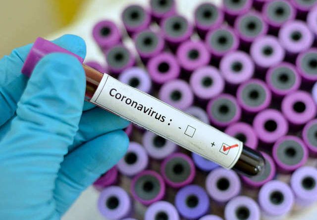 Coronavirus test